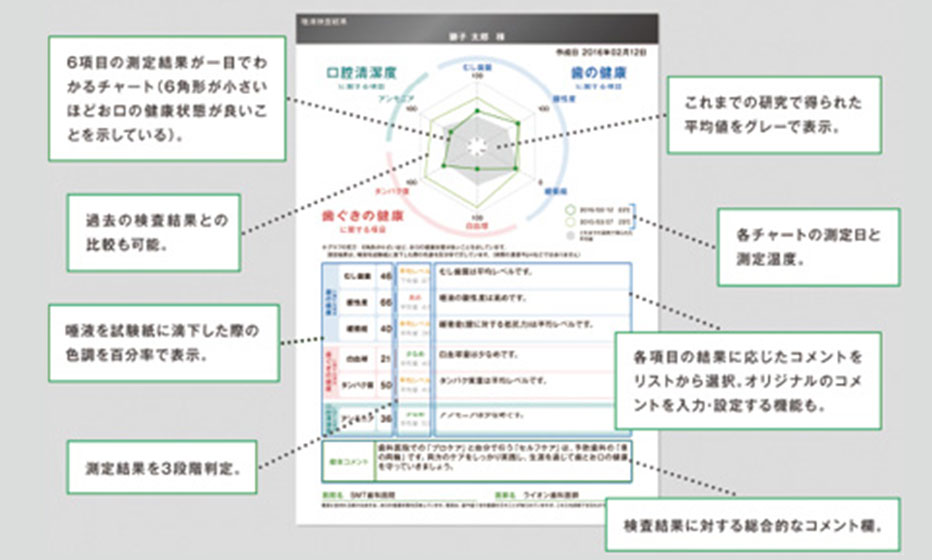 SMT　唾液検査システム