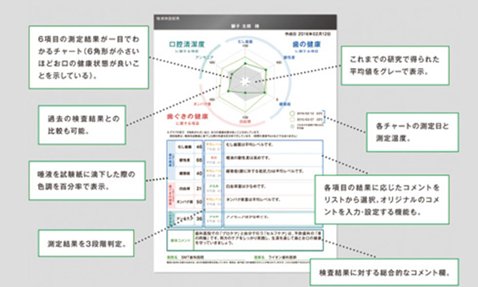 SMT　唾液検査システム